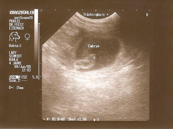 embryo